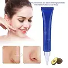 20g Face Freckle Removal Cream Lightening Age Spots Freckles Whitening Facia BBY