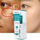 20ml Dark Spot Remover Whitening Freckle Cream for Body, Underarm Cream Restores