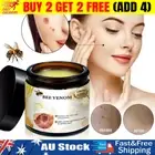 Bee Venom Skin Tag Removal Treatment Cream For Body Care Mole Corn Skin Wart 60G