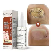 Fungal Nail Care Serum Thick Nail Soft Nail Repair Essence Lotion Toe Whitening Treatment Care 1pc