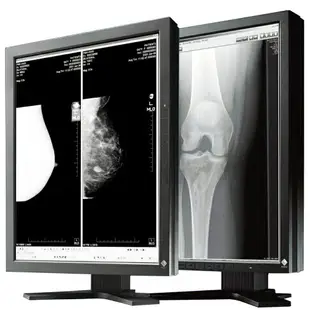 CR/CT醫用顯示器醫療EIZO藝卓灰階黑白GX240/GX340/GS220/320/520