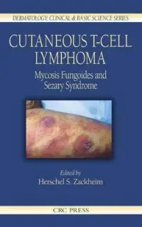 在飛比找博客來優惠-Cutaneous T-Cell Lymphoma: Myc