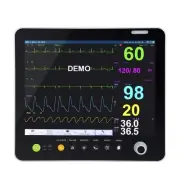 Portable Modular Patient Monitor 15 Inch Display Advanced ICU Monitoring ECG