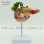 (MD-B_1569)醫學胰腺十二指腸膽囊病理模型 膽結石外科消化科系統肝膽科模型