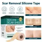 Scar Removal Silicone Tape: 4×150cm, FDA Approved for Hypertrophic & Keloids