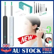 Wireless HD Ear Wax Remover Camera Ear Endoscope Spoon Pick Ear Cleaning Tool RO