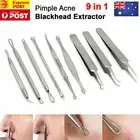 Blackhead Remover Extractor Tool Pimple Blemish Popper Comedone Kit Clip 9pcs