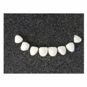 3Pcs No.21# Teeth Veneer Dental Veneers Tooth Whitening Clinic Bright White LMS