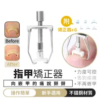 在飛比找蝦皮購物優惠-【指甲矯正器】七件組 嵌甲 凍甲 卷甲 矯正器 甲溝炎 指甲