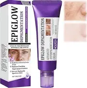 Epiglow Melanex Advanced Hyperpigmentation Cream, Dark Spot Corrector For Face Neck, Brightening With Niacinamide, Dark Spot Correcting Glow Serum, Even Skin Tone, Anti-Aging Fine Lines (1Pcs)