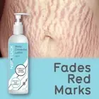 NIP & TUCK BODY CORRECTIVE LOTION STRETCH MARK LOTION