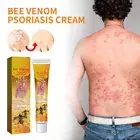 Bee Venom Psoriasis Cream Dermatitis Eczema Ointment Healing Antibacterial Care·