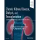 Chronic Kidney Disease, Dialysis, and Transplantation: A Companion to Brenner and Rector’s the Kidney