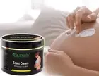 Stretch Marks Cream | Moisturizes the Skin Prevents & Reduces Stretch Marks 100g