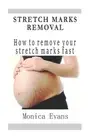 Stretch Marks Removal: How to remove your stretch marks fast by Monica Evans (En