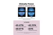 COSRX The Niacinamide 15 Serum 20ml