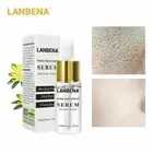 2 pack Pore Shrinkage Liquid Remove Blackhead Whitehead Acne Cleansing Whitening