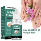Nail Fungus Repair Lotion Nail Polish Essence Anti Fungus Z6O2 }й Nail Q2P0