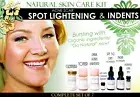 Natural Skin Care Kit For Acne Scar Spot Lightening and Pitted Scars Set of 7