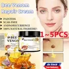 1-5x Bee-Venom Skin Tag Removal Treatment CreamBody Care Mole Corn Wart Remover