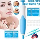 Natural Painless Skin Tag Mole Wart Removal Kit Auto SKIN TAG Bands Remover Kit