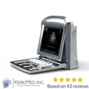 Chison ECO1Vet LED Diagnostic Ultrasound With Two Probes: Rectal, Micro-Convex