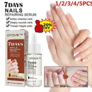 GFOUK 7Days Nail Growth And Strengthening Serum,Nail Growth And Strength Serum 2PCS JAY SUING