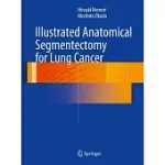 ILLUSTRATED ANATOMICAL SEGMENTECTOMY FOR LUNG CANCER