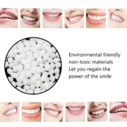 Temporary Tooth Repair Kit Teeth And Gaps FalseTeeth Solid Glue Denture Adhesive