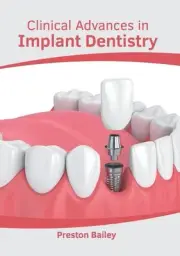 Clinical Advances in Implant Dentistry by Preston Bailey (English) Hardcover Boo