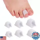 Nolimvita Hammer Toe Straightener Corrector - Toe Spacers Toe Splints Realign