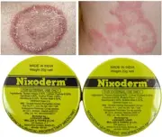 Nixoderm Cream 20g each For Skin Problems Blemishes & Pimples (pack of 2)