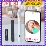 Wireless WiFi Ear Wax Remover Camera Ear Endoscope Spoon Pick Cleaning Tool BP