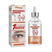 Speedy Milia Remover, Milia Remover Milia Treatment, Speedy Milia Remover, Speedy Milia Remover, Helps Dissolve And Milia,hww