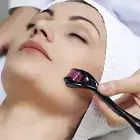 Derma Skin Roller 1 mm Stretch Marks,Acne, Scars,Cellulite,Wrinkles (540 Pin)