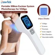 Home Use Treatment Eczema Vitiligo Psoriasis 308nm Phototherpay Device 64 Diodes