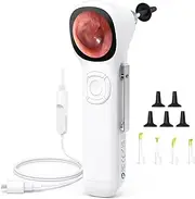 ScopeAround Digital Otoscope w/IPS Screen, 720p HD Smart Video Otoscope with Light, Ear Scope Otoscope with Camera Ear Wax Removal Camera, Ear Checker, Power On and Go