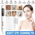 Laser Pen Skin Tag Remover Age Spot Mole Freckle Wart Tattoo Removal 5 x Needles
