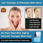 NEW LACTIC ACID ANTI AGING WRINKLE SERUM HYALURONIC ACID SAFE FINE LINE REMOVER
