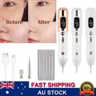 Portable Tag Remover Pen Face Freckle Wart Mole Dark Spot Laser Machine 9 Gears
