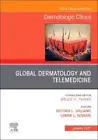 Global Dermatology and Telemedicine, An Issue of Dermatologic Clinics, Volume