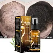 Biotin hair growth spray anti hair loss fast regeneration scalp treatment essence