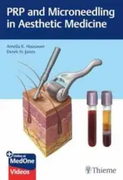 PRP and Microneedling in Aesthetic - Hardcover, by Hausauer Amelia K.; - New h