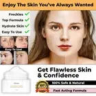 NEW FRECKLE REMOVER CREAM ANTI AGING FACE