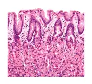 Set of 100 Microscope Prepared Typical Histology Slides for Medical Study Edu...