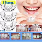 1+2+3 Stage Orthodontic Teeth Corrector Dental Braces Tooth Retainer Straighten