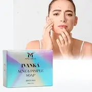 Ivanka Acne & Pimples Soap | Acne Soap bar for body and face