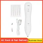 Electric Mole Freckle Removal Pen Three Levels Adjustable Spot Tattoo Remover...
