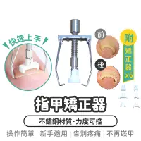 在飛比找蝦皮購物優惠-【指甲矯正器】七件組 嵌甲 凍甲 卷甲 矯正器 甲溝炎 指甲