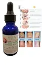 Organic Toenail Fungus Treatment Extra Strength - nail repair, toenail softener
